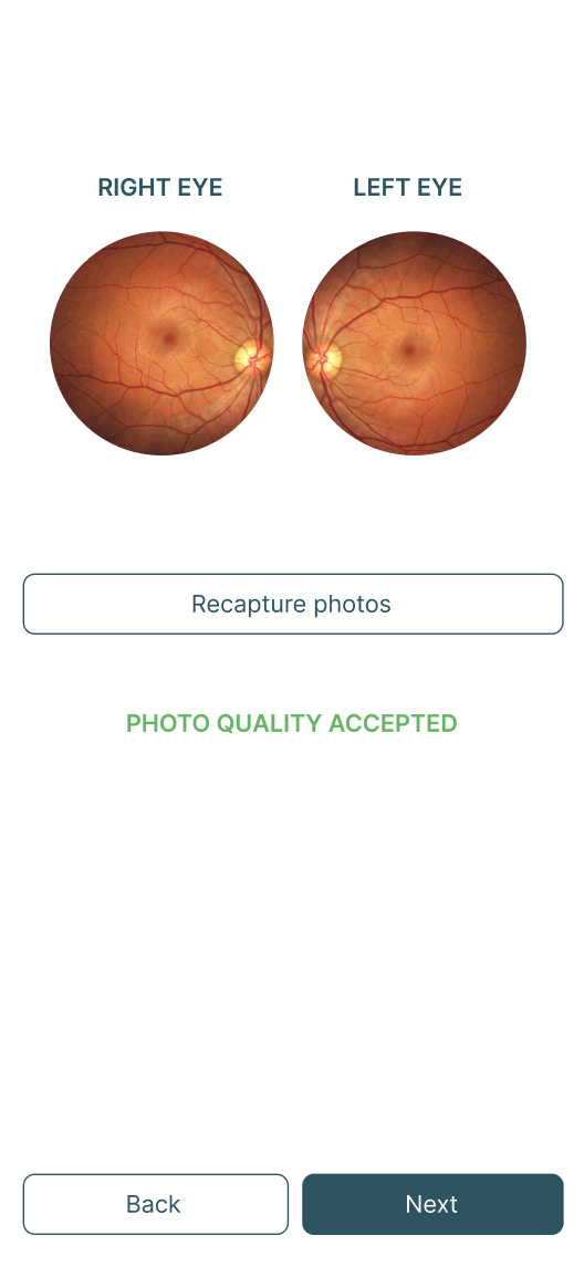 Post-scan — photo quality check