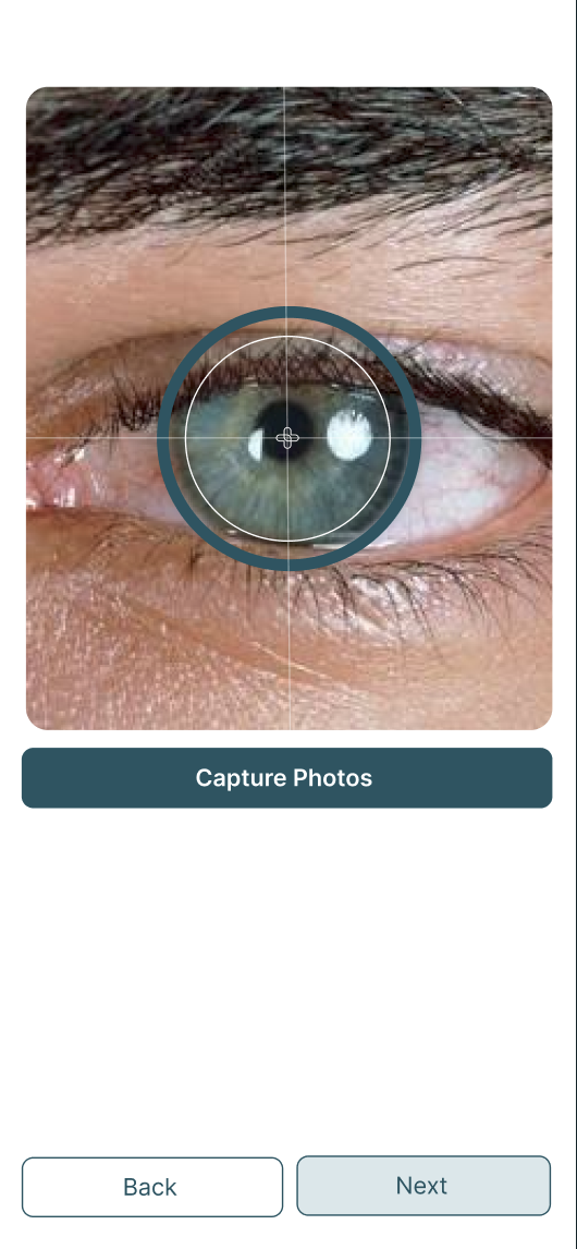 Retinal imaging — scan screen